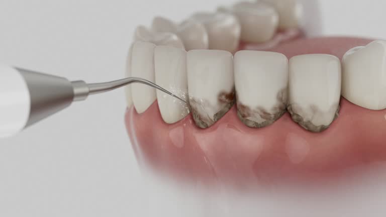 Reliable Wisdom Tooth Removal contractor in Presque Isle County County, MI by Dentist Open Now